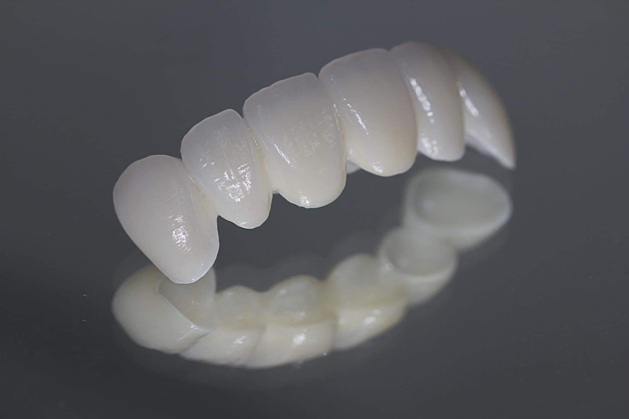 セラミックの歯の色の特徴イメージ