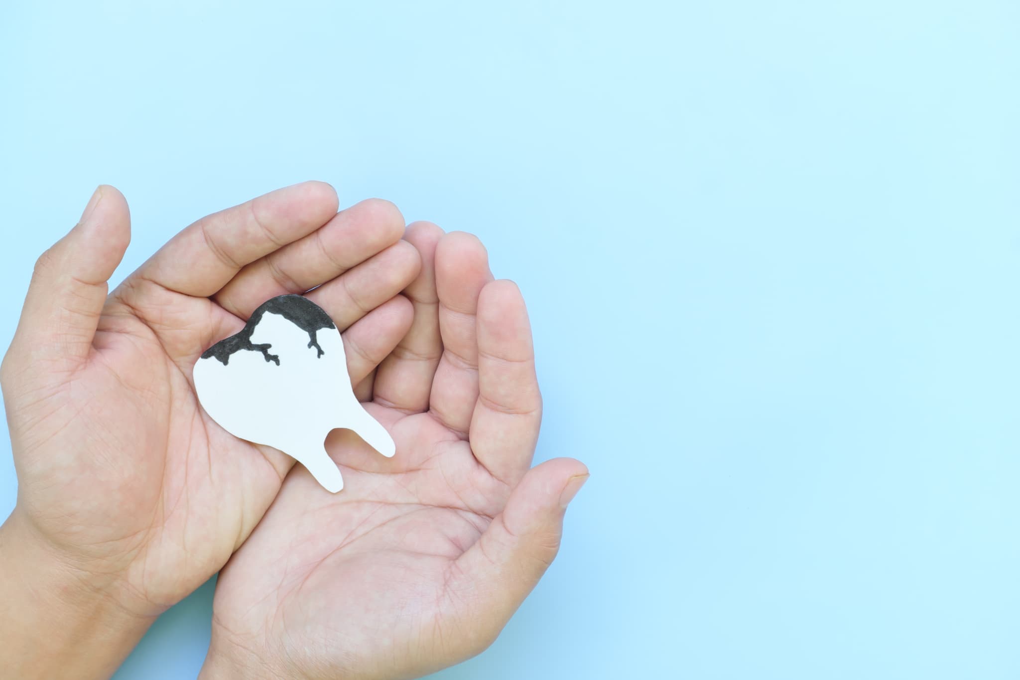 虫歯になった歯のイメージ