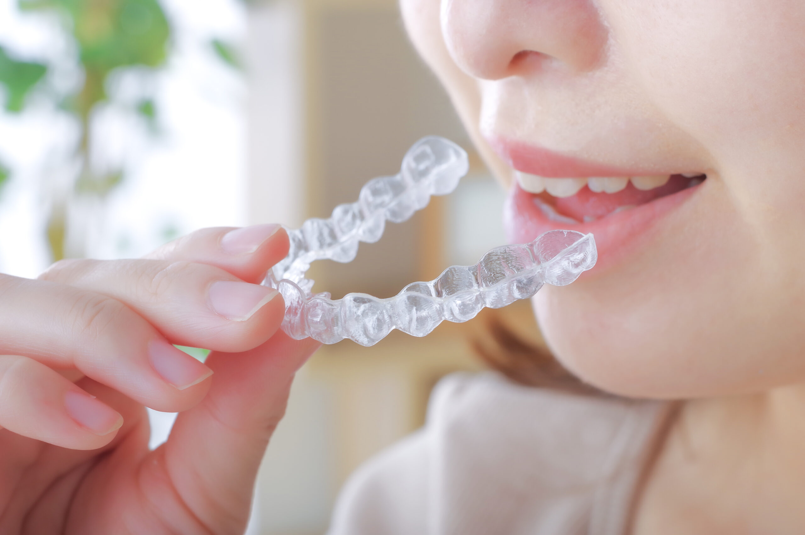 抜歯は必要?インビザライン治療で抜歯をするメリットを解説!-5