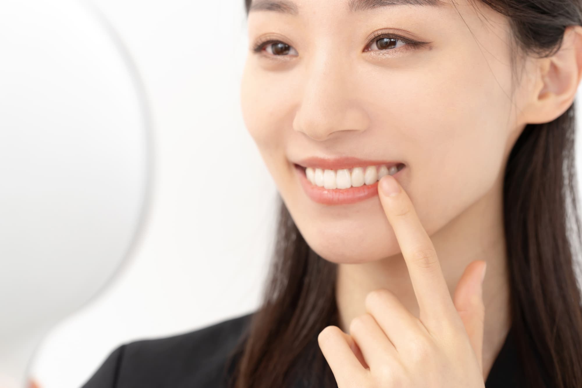虫歯を治療してホワイトニングをした女性