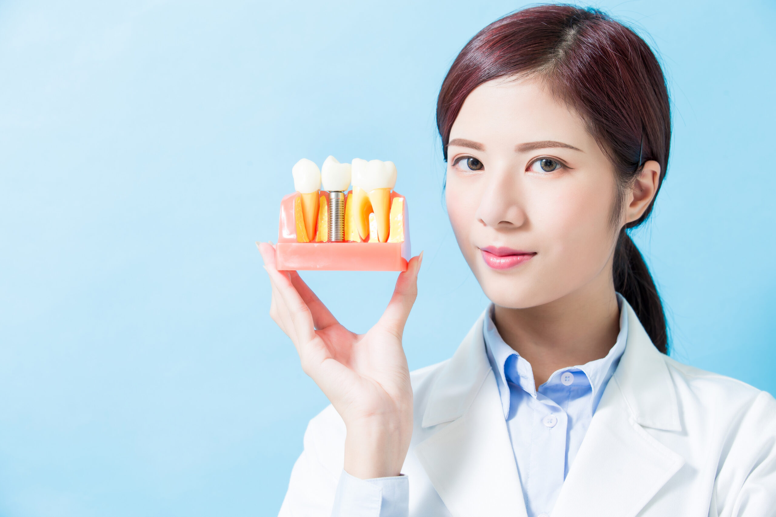 インプラント治療で失敗しないために！4つの失敗例と対策！-1